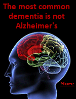 Frontotemporal dementia affects the parts of the brain that control social skills, decision-making, and judgment. It tends to affect people between the ages of 45 and 60.